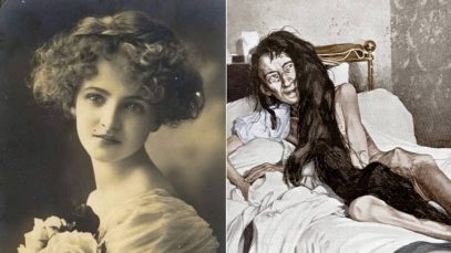 Blanche-Monnier